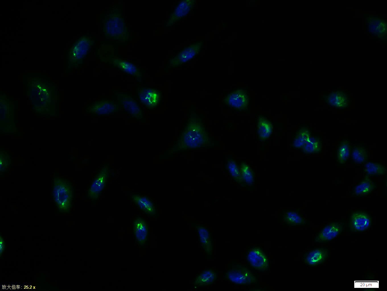 Anti-SLC2A4 Polyclonal Antibody