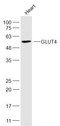 Anti-SLC2A4 Polyclonal Antibody