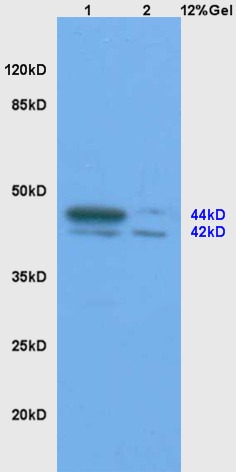 Anti-SHBG Polyclonal Antibody