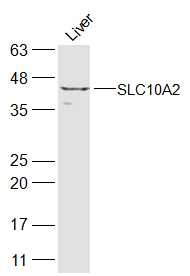 Anti-SLC10A2 Polyclonal Antibody