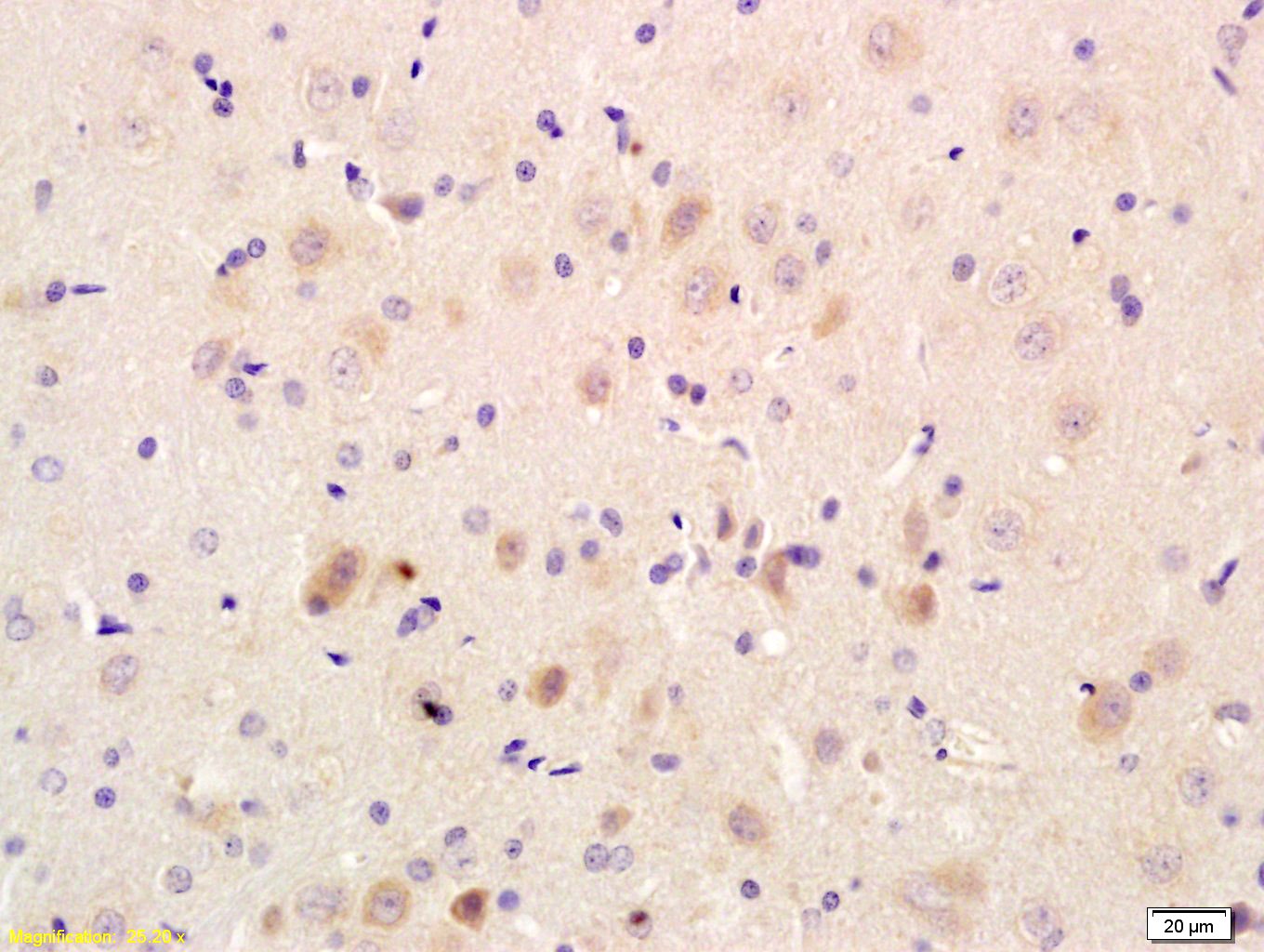 Anti-SLC2A3 Polyclonal Antibody