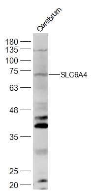 Anti-Serotonin transporter Polyclonal Antibody