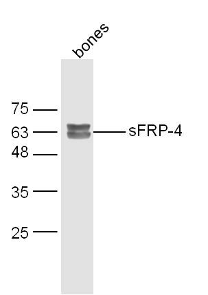 Anti-SFRP4 Polyclonal Antibody