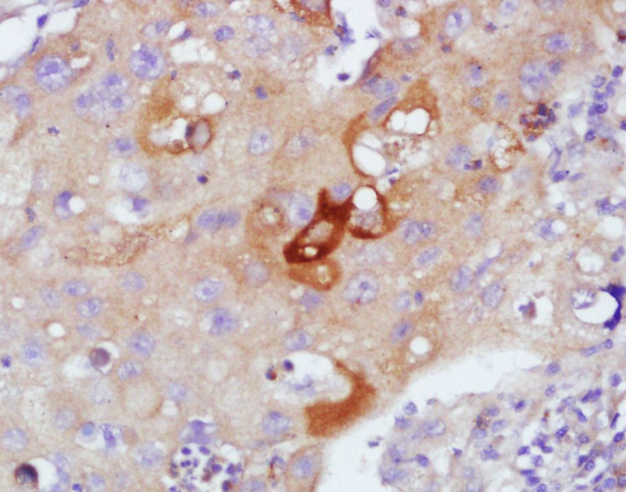 Anti-SFTPA1 Polyclonal Antibody