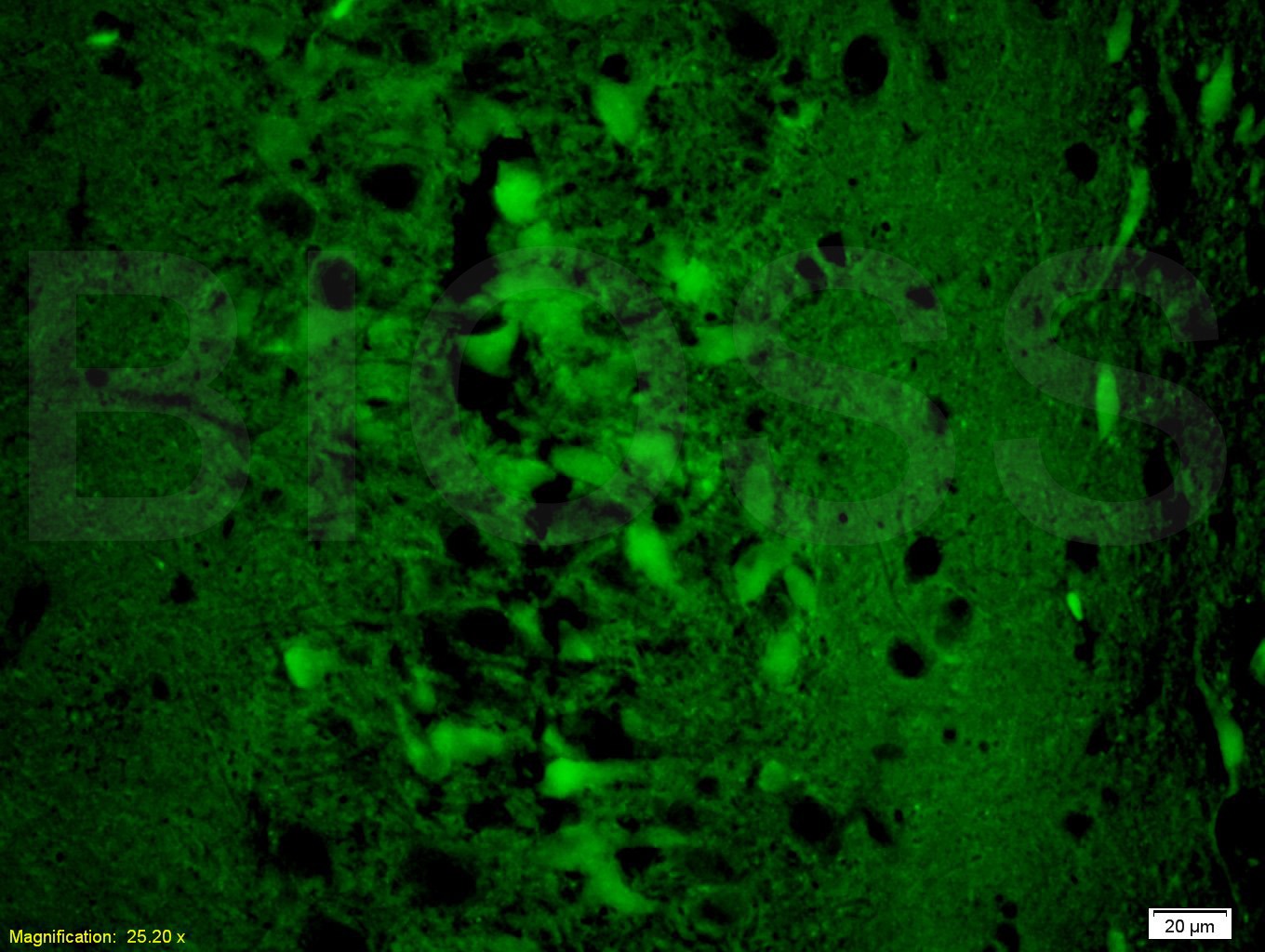 Anti-SLC2A3 Polyclonal Antibody