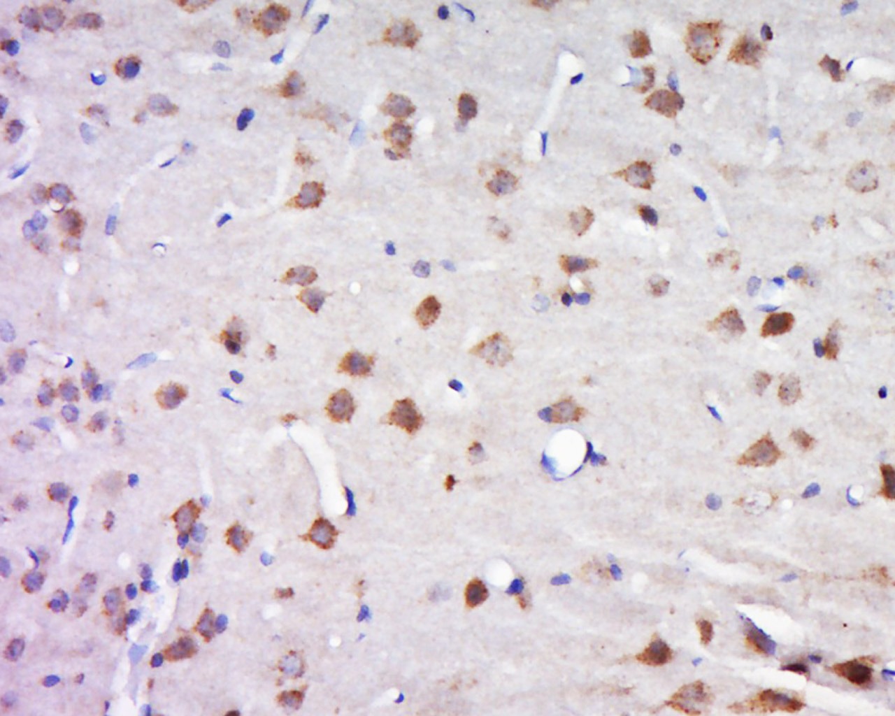 Anti-SLC32A1 Polyclonal Antibody