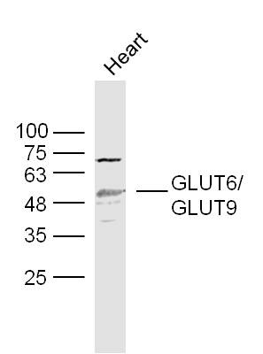 Anti-SLC2A6 Polyclonal Antibody