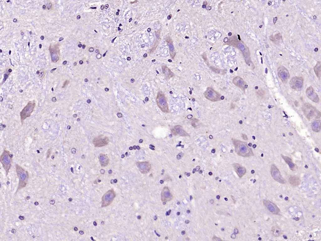 Anti-SLC22A17 Polyclonal Antibody 2
