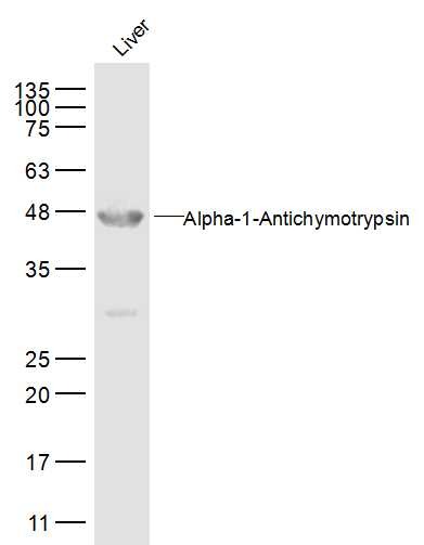 Anti-Serpin A3 Polyclonal Antibody