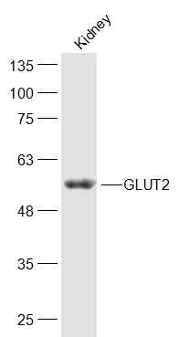 Anti-SLC2A2 Polyclonal Antibody 2
