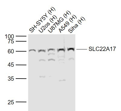Anti-SLC22A17 Polyclonal Antibody 2