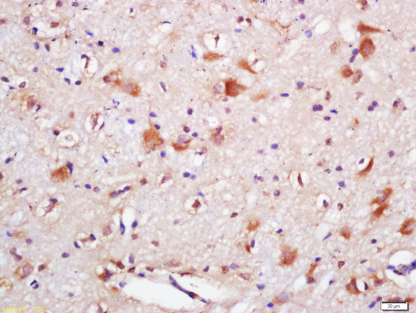 Anti-SQSTM1/P62 Polyclonal Antibody