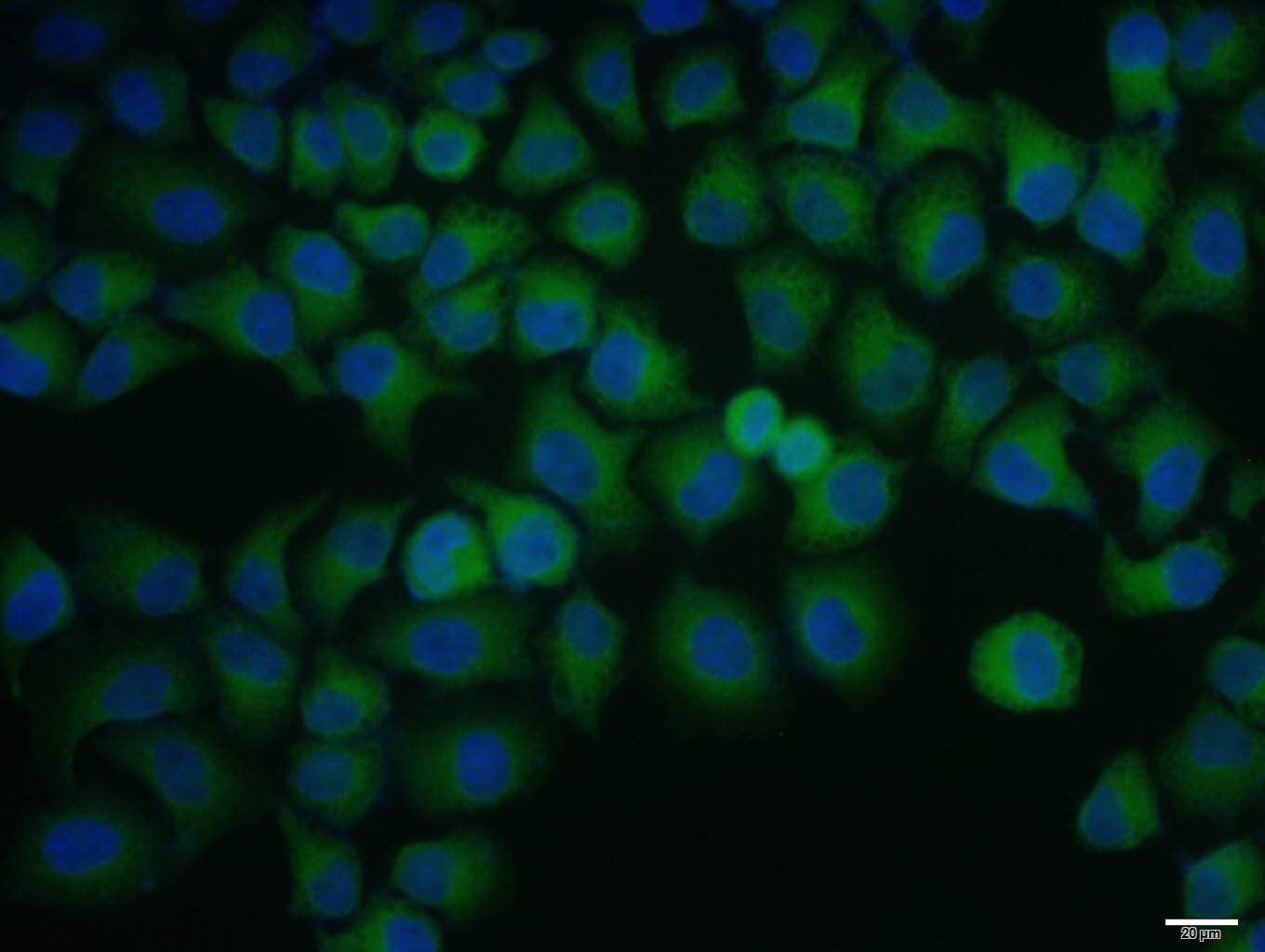 Anti-SREBP2 Polyclonal Antibody