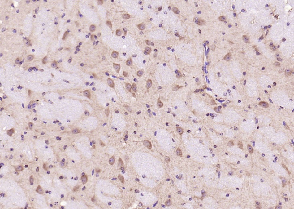 Anti-STAT3 Antibody (9V551)