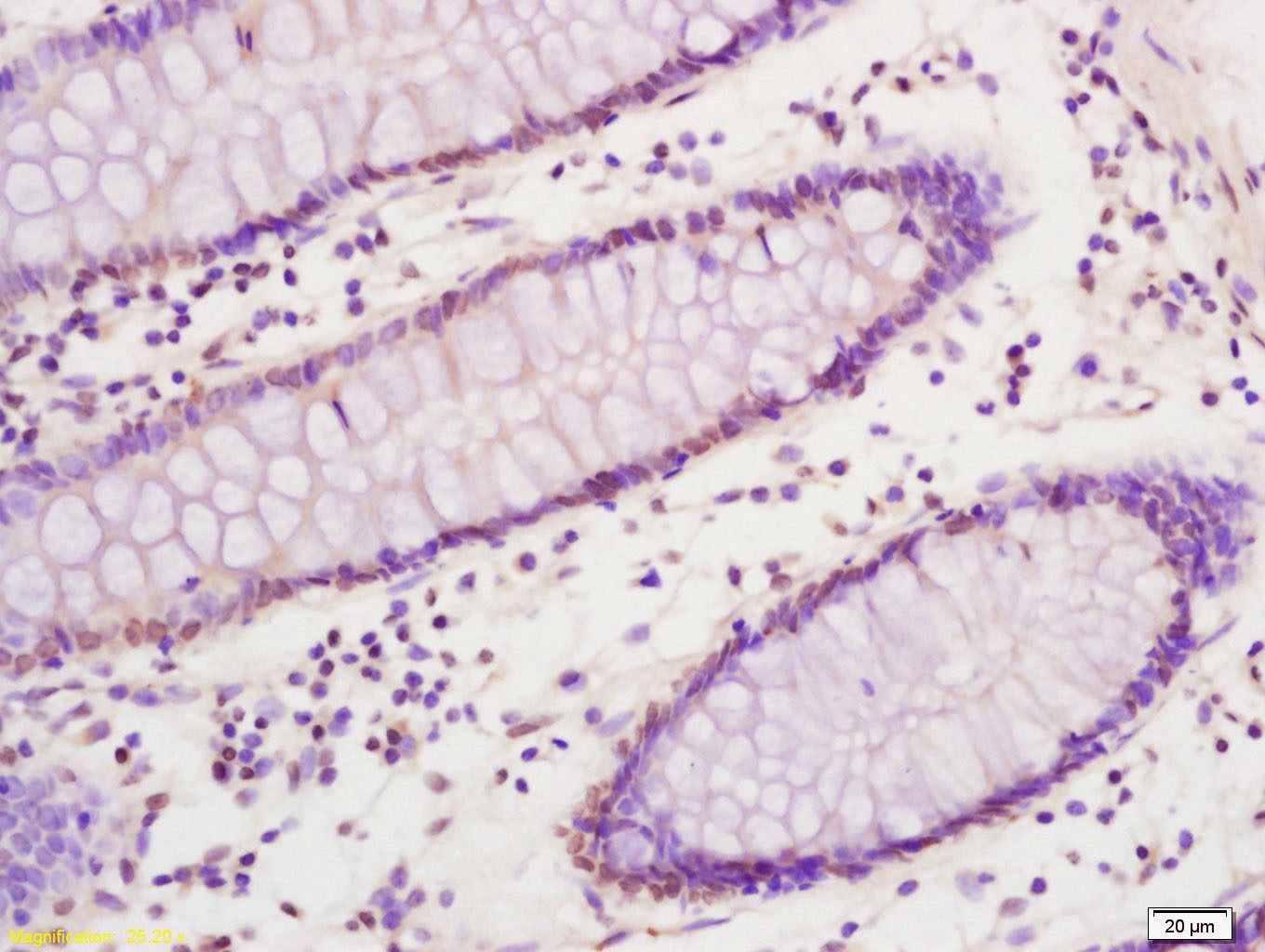 Anti-SREBP1 Polyclonal Antibody