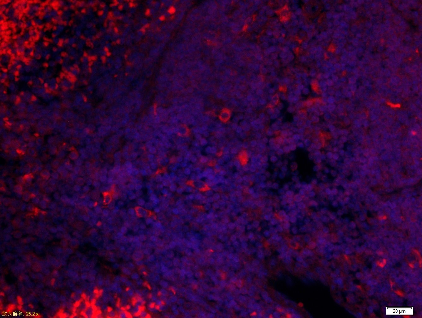 Anti-Stabilin-2 Polyclonal Antibody
