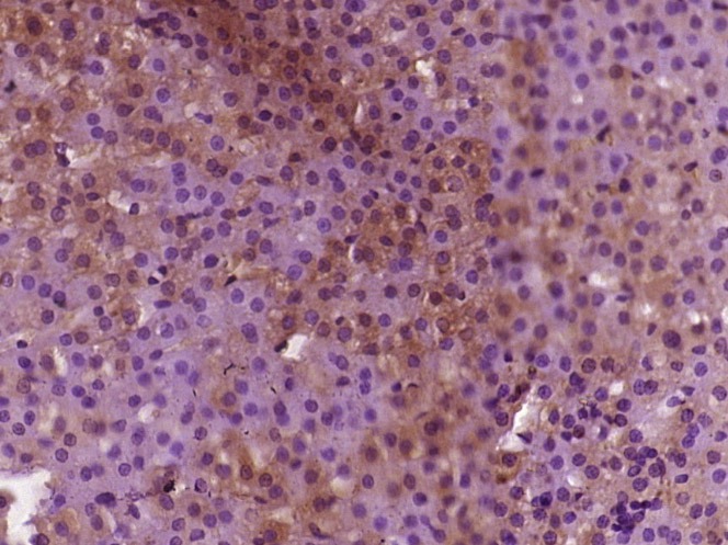 Anti-SREBP1 Polyclonal Antibody