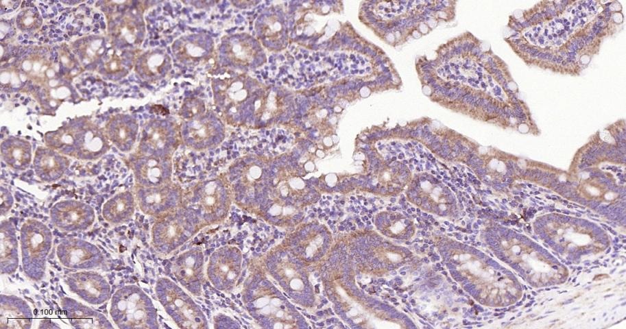 Anti-SQSTM1/p62 Antibody (9J396)