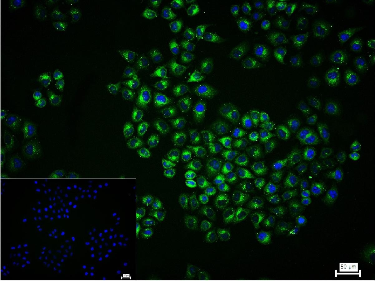 Anti-SQSTM1/p62 Polyclonal Antibody 2