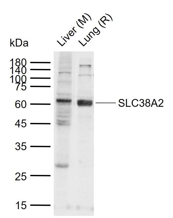 Anti-SLC38A2 Polyclonal Antibody