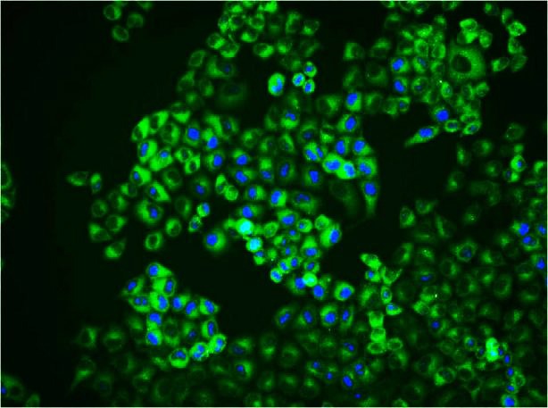 Anti-SQSTM1/p62 Antibody (9J396)