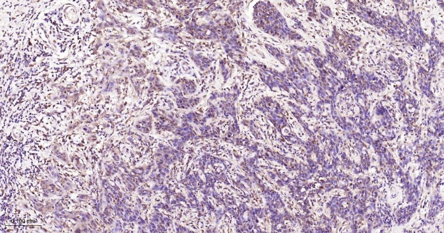 Anti-STAT3 Antibody (9V551)