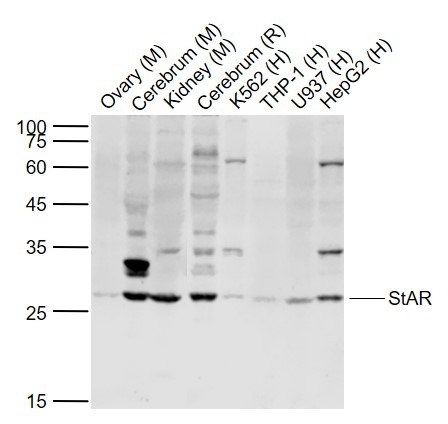 Anti-StAR Polyclonal Antibody