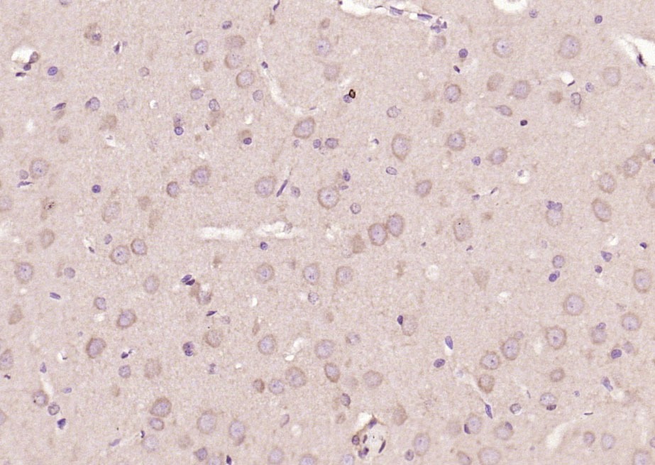 Anti-STAT3 Antibody (9V551)