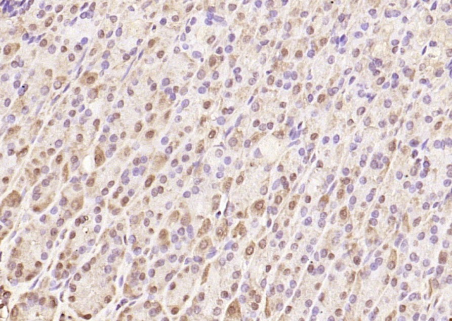 Anti-SQSTM1/P62 Polyclonal Antibody