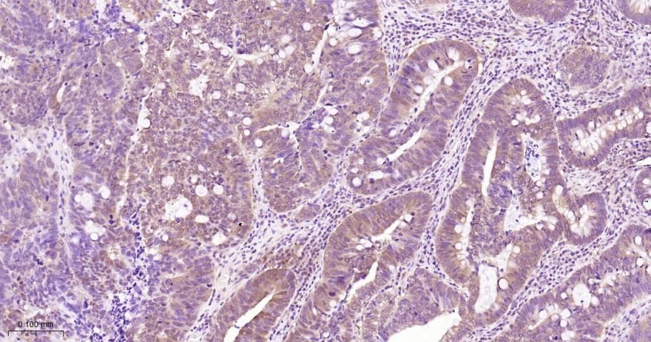 Anti-STAT3 Antibody (9V551)