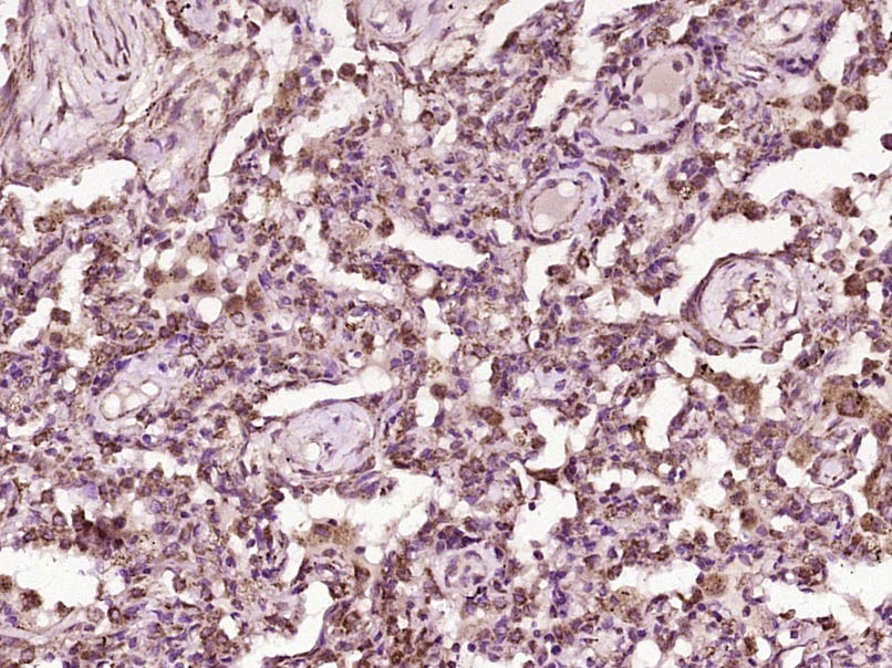 Anti-ST2/IL-1 RL1 Polyclonal Antibody