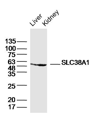 Anti-SLC38A1 Polyclonal Antibody