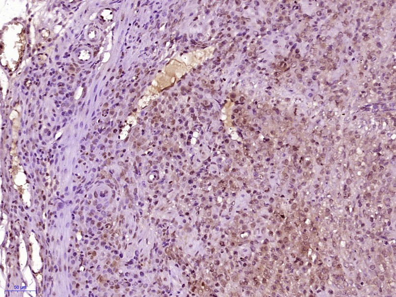 Anti-SHOX2 Polyclonal Antibody
