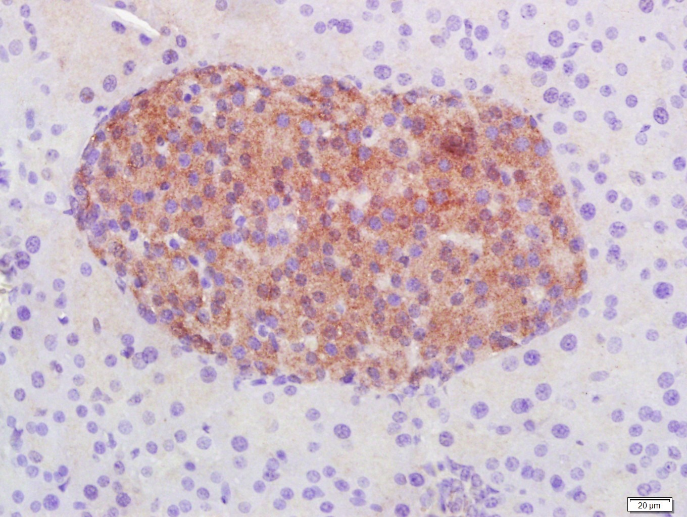 Anti-STAT3 Antibody (9V551)