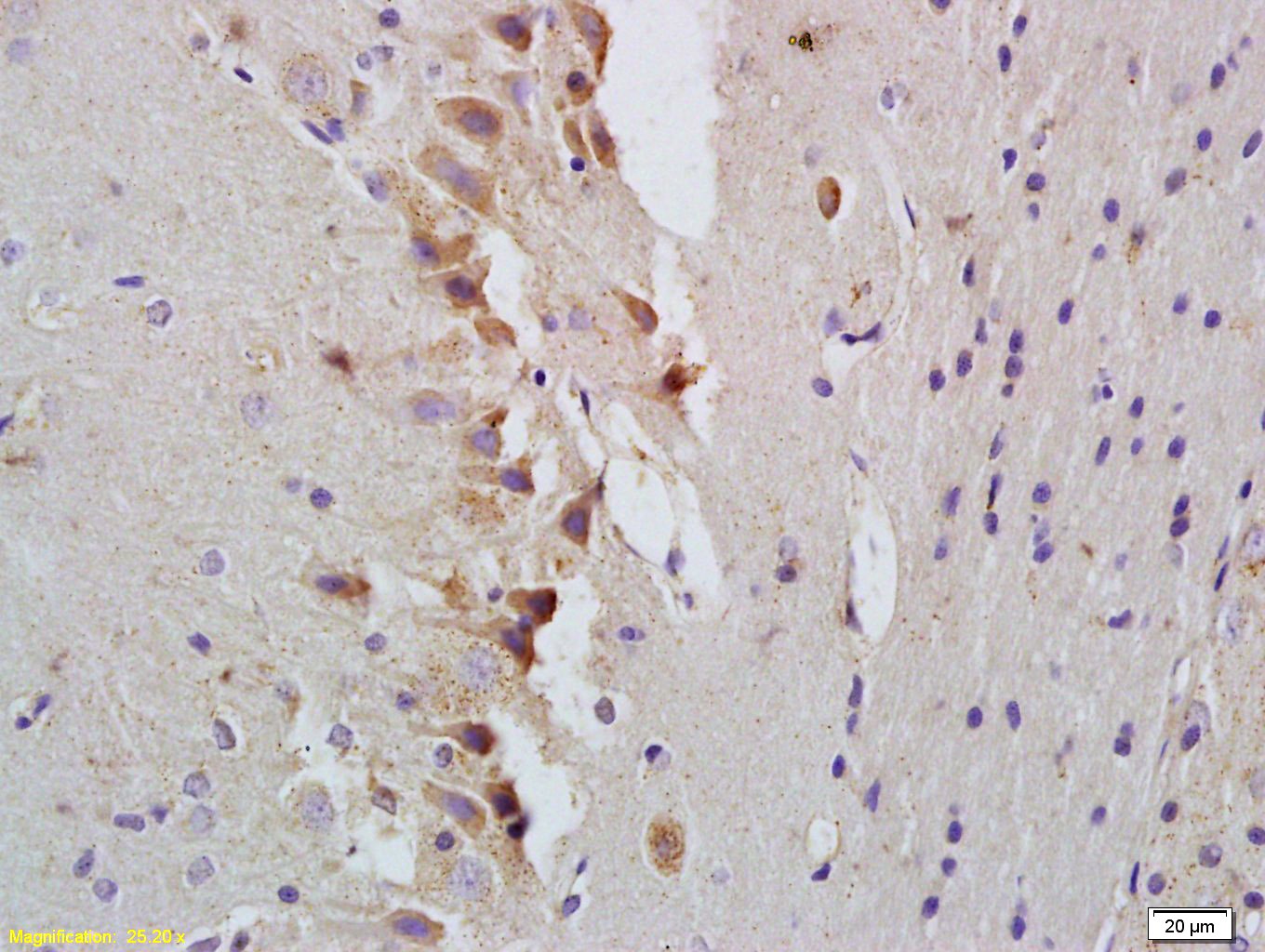 Anti-STAT1 Polyclonal Antibody