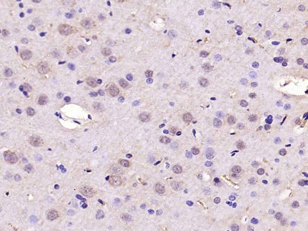 Anti-SREBP1 Polyclonal Antibody