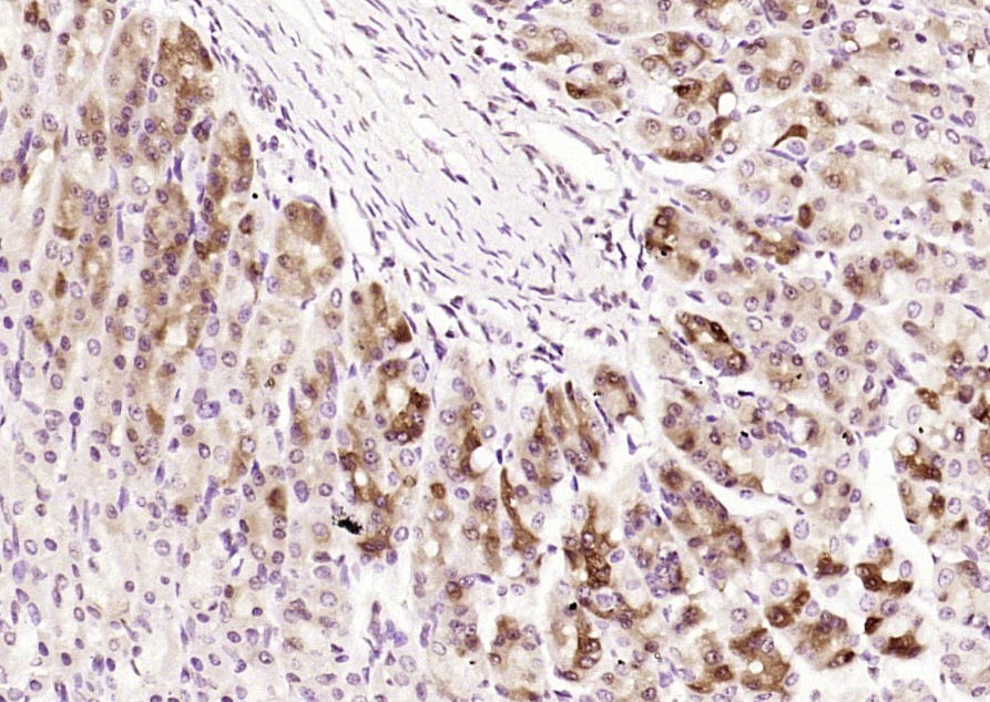 Anti-SHH Polyclonal Antibody