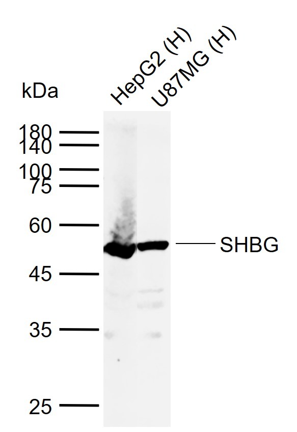 Anti-SHBG Polyclonal Antibody