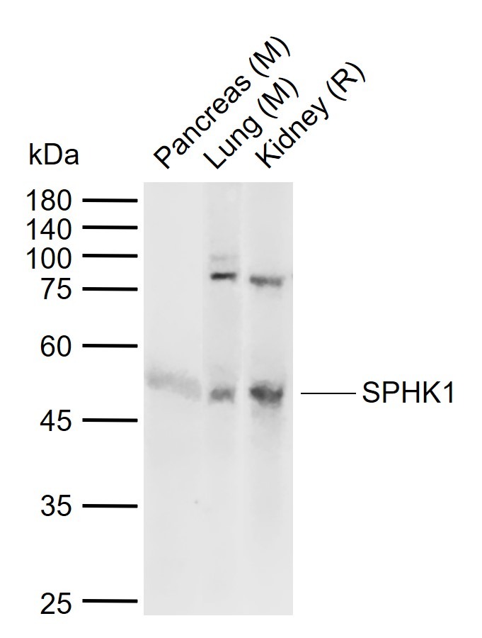 Anti-Sphingosine Kinase 1/SPHK1 Polyclonal Antibody