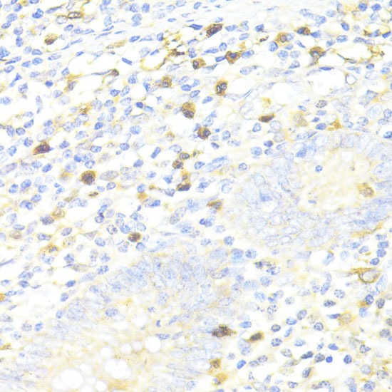 Anti-SQSTM1/p62 Polyclonal Antibody 2