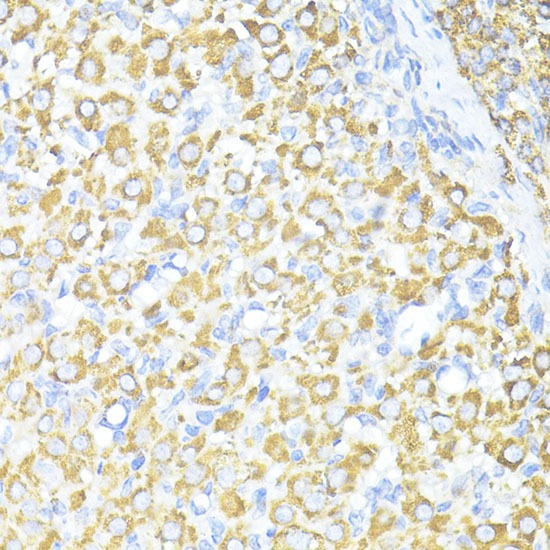 Anti-SQSTM1/p62 Polyclonal Antibody 2