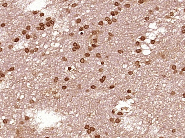 Anti-STAT1 Polyclonal Antibody 2