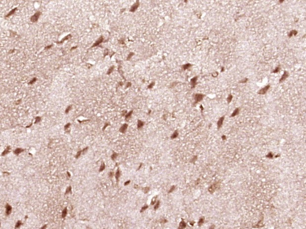 Anti-STAT1 Polyclonal Antibody 2