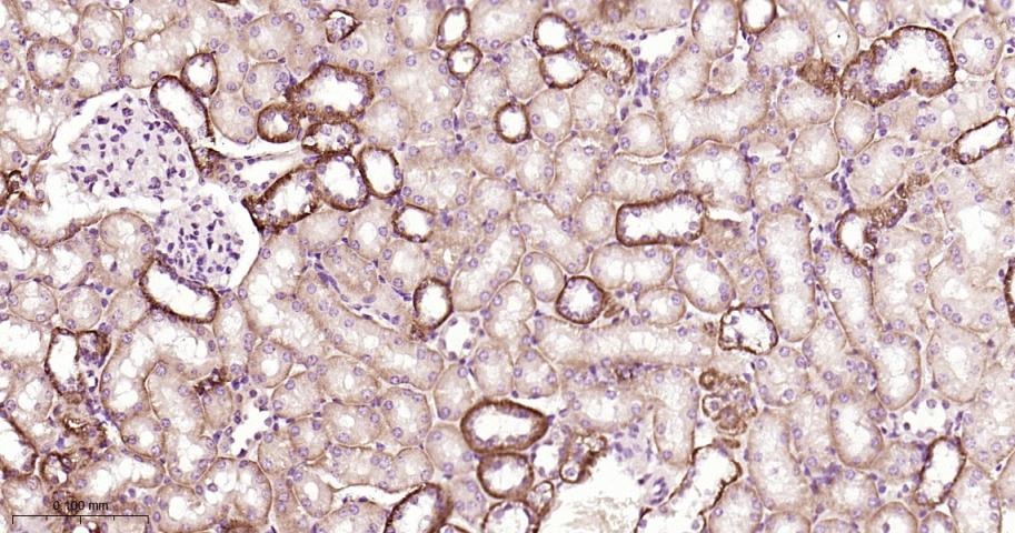 Anti-STAT3 Polyclonal Antibody 2