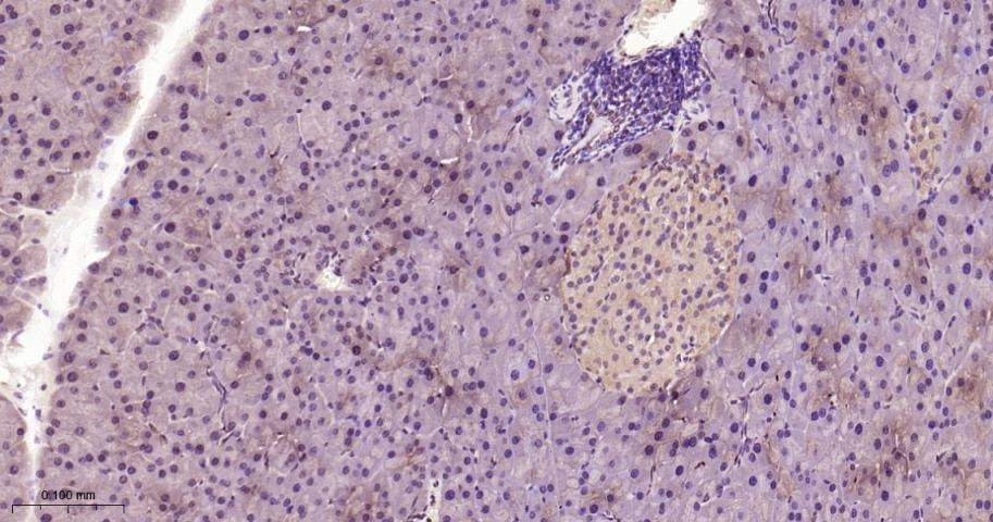 Anti-STAT3 Polyclonal Antibody 2