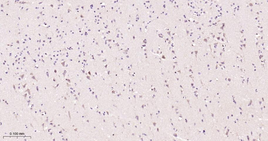 Anti-STAT3 Antibody (9V551)