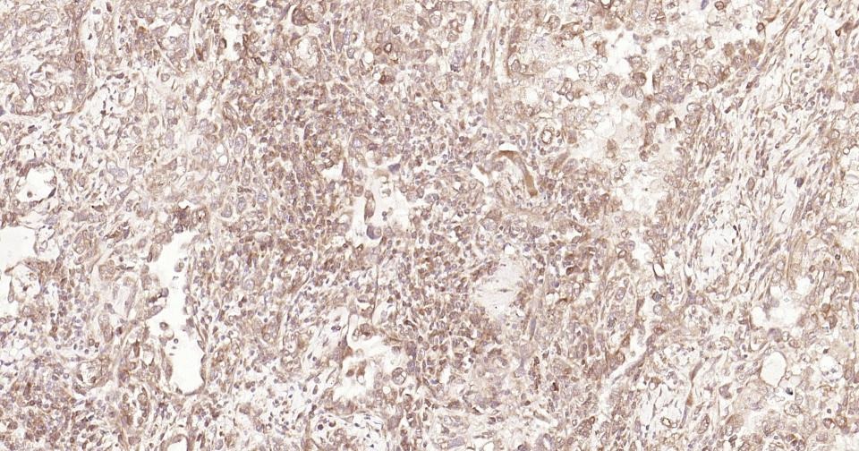 Anti-STAT3 Antibody (3R504)