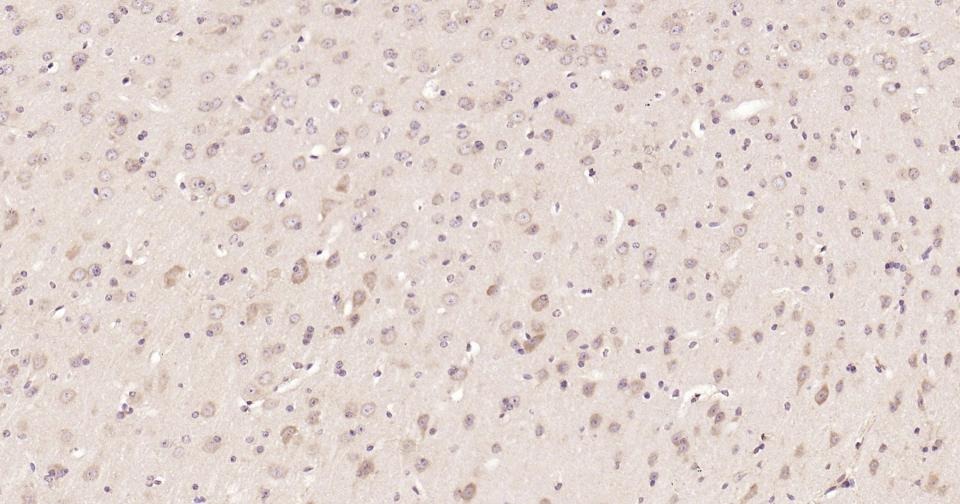 Anti-STAT3 Antibody (3R504)
