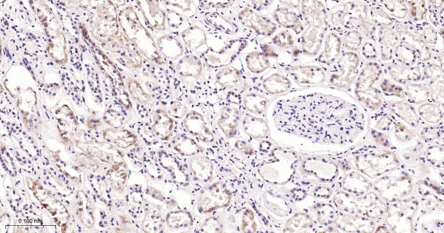 Anti-STAT3 Antibody (7U765)