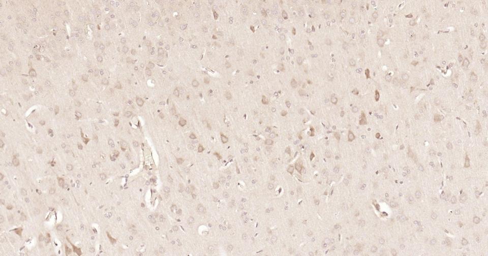 Anti-STAT3 Antibody (3R504)